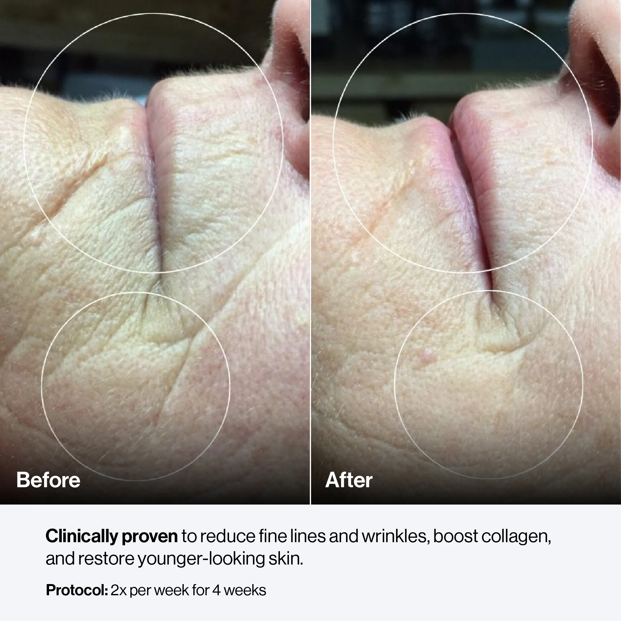 Celluma CONTOUR PLUS - Image 11