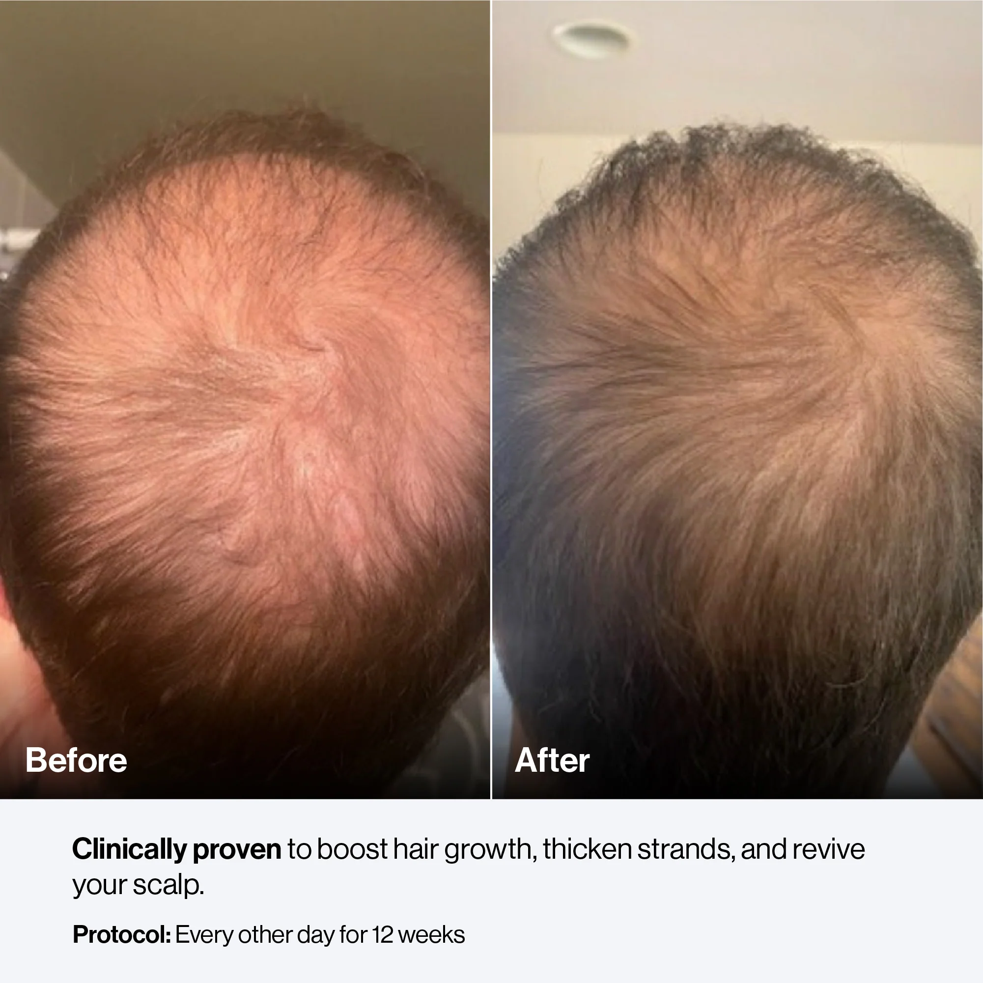 Celluma CONTOUR PLUS - Image 20