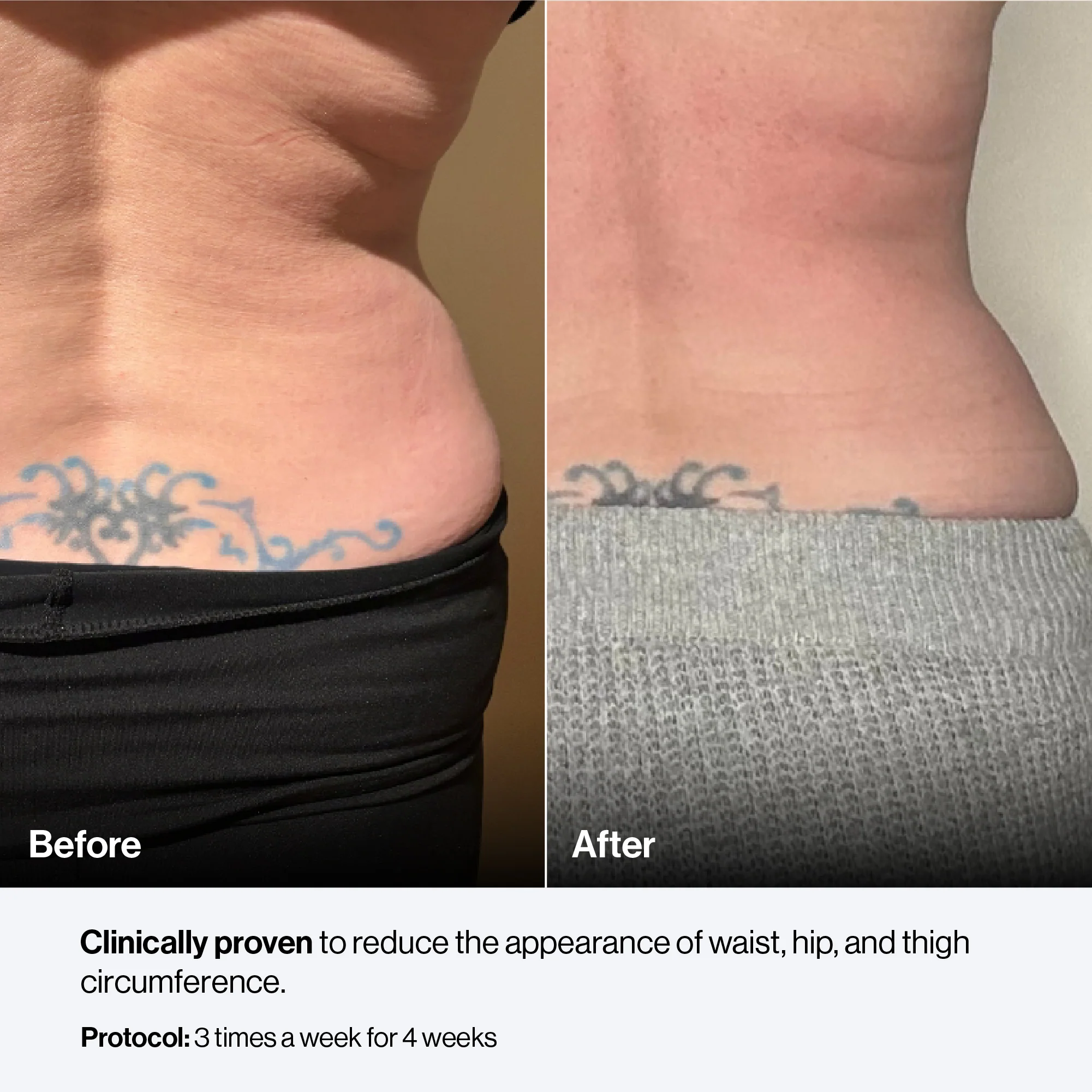 Celluma CONTOUR PLUS - Image 22