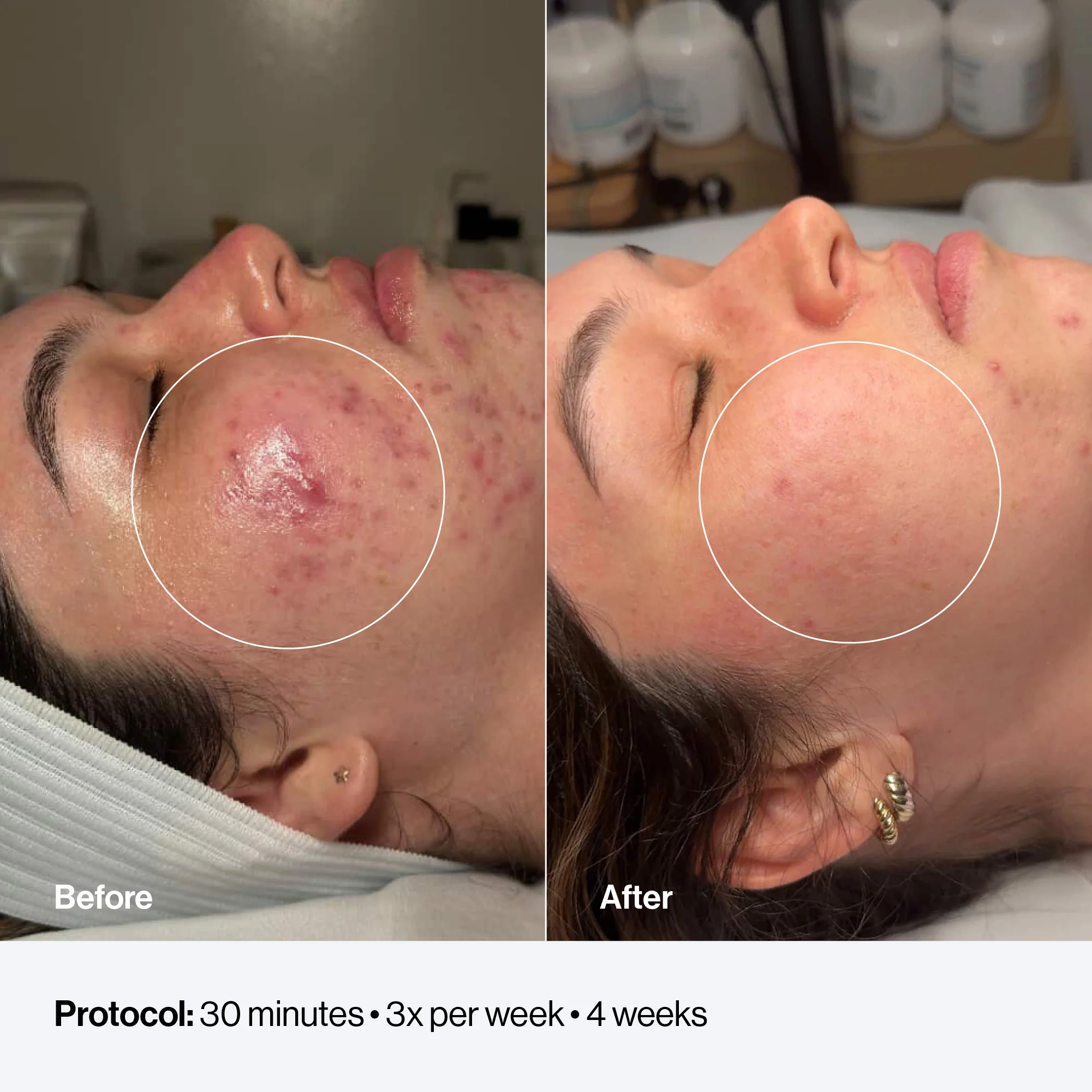 Celluma FACE - Image 5