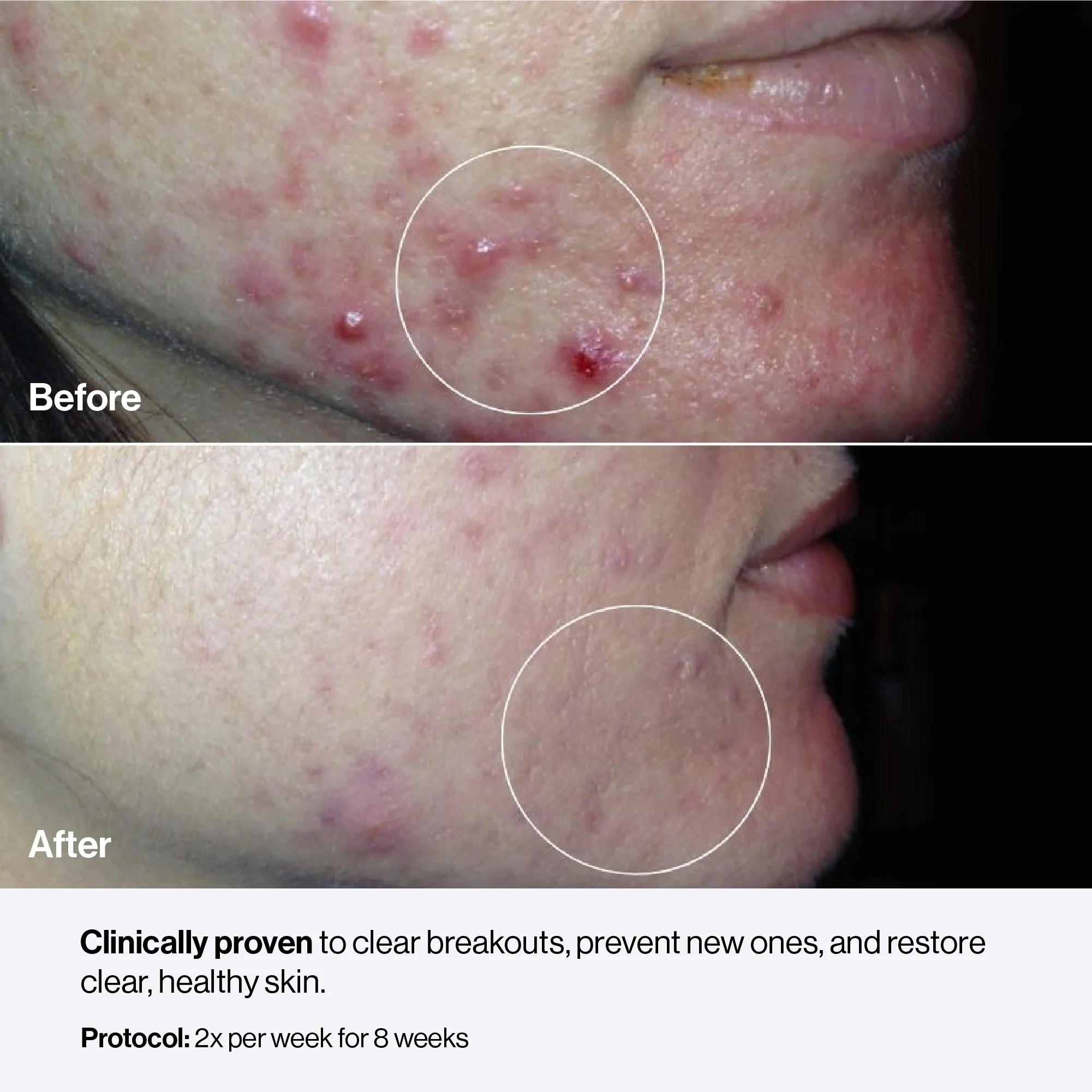 Celluma NOVA - Image 13