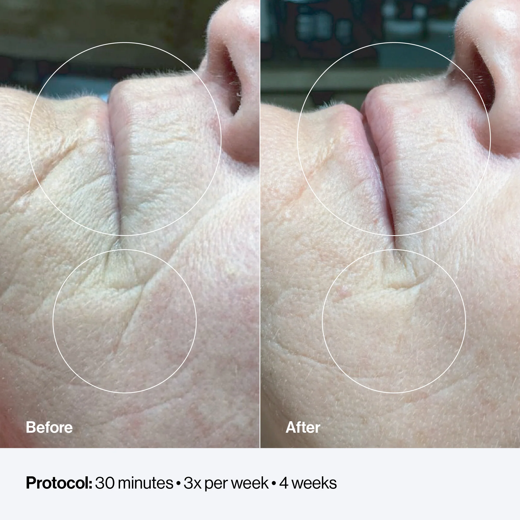 Celluma FACE - Image 6